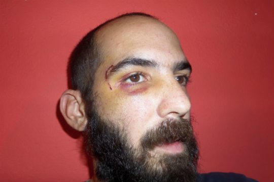 «Το χτύπημα δεν πτοεί κανέναν από τους συντρόφους»