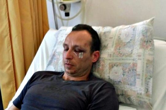 Κρήτη: ξυλοδαρμός γιατρού που υπερασπίστηκε μετανάστες