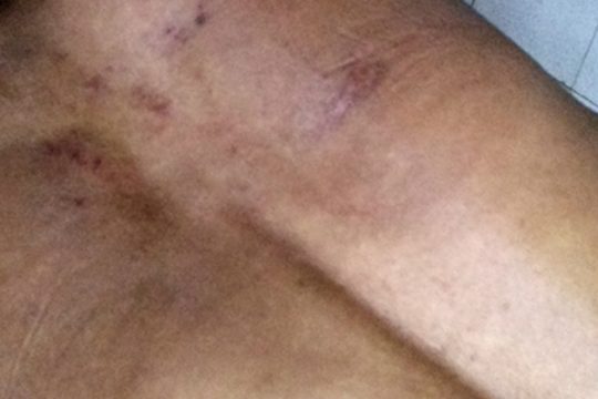 Βίαιη επίθεση με ρατσιστικό κίνητρο