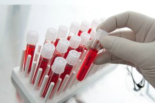 «Διασφαλισμένη η επάρκεια αίματος»