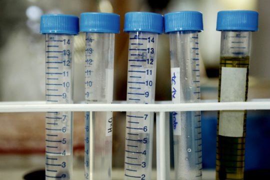 Τέσσερις υποχρεωτικές ιατρικές εξετάσεις αλλιώς πρόστιμο