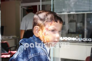 Πέταξε τον καφέ που έβραζε σε 2χρονο παιδί!