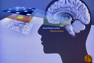 Η Θεσσαλονίκη φιλοξενεί την ελίτ των επιστημόνων του εγκεφάλου