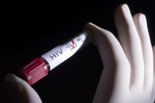 Ανακαλύφθηκε μια «αχίλλειος πτέρνα» στον ιό HIV του AIDS