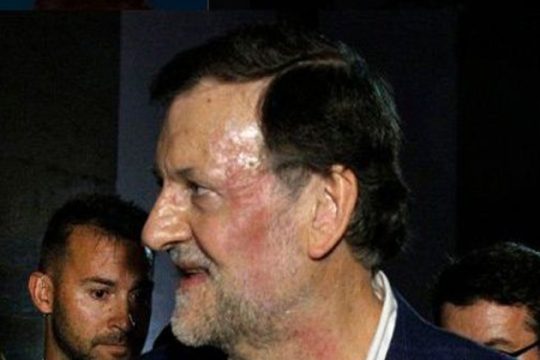Ντιρέκτ στη… λιτότητα