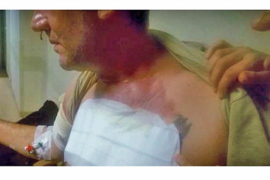 Και θύμα εργατικού ατυχήματος και… απολυμένος