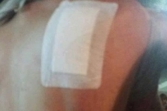 Νέα επεισόδια με ακροδεξιά στοιχεία στο hotspot της Λέρου