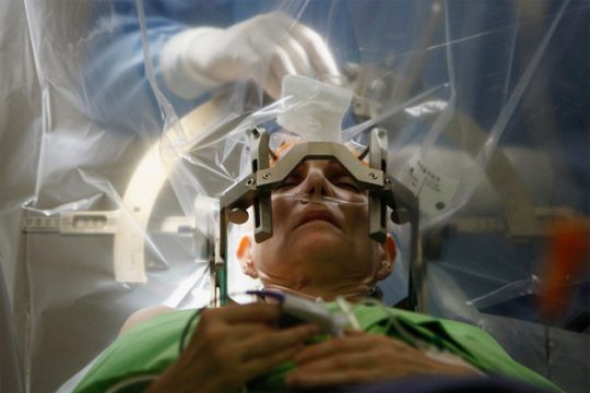 Επέμβαση στον εγκέφαλο, με τον ασθενή να συνομιλεί με τους γιατρούς