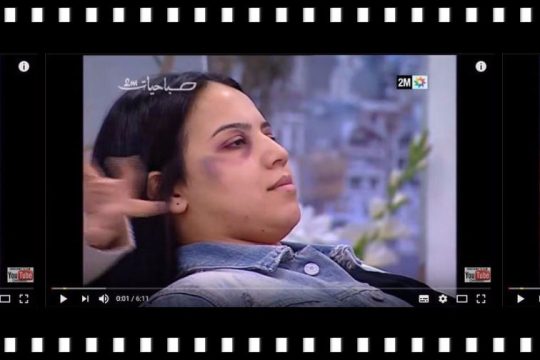 Με μακιγιάζ «κρύβεται» ο ξυλοδαρμός των γυναικών