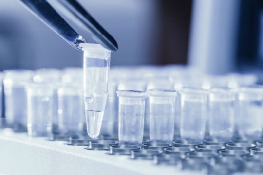 Το DNA στο φαγητό «έκαψε» τον δολοφόνο