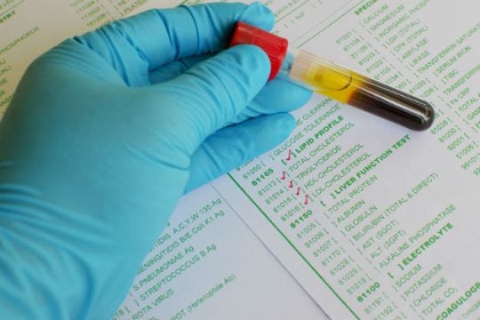 Δημοσιεύματα για το πόσο κακή είναι η «κακή χοληστερίνη» με… συνταγή φαρμακευτικής;