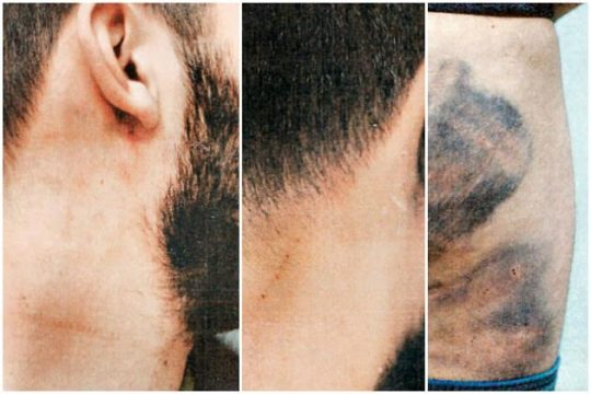 Στα βασανιστήρια δεν κάνουν διακρίσεις…