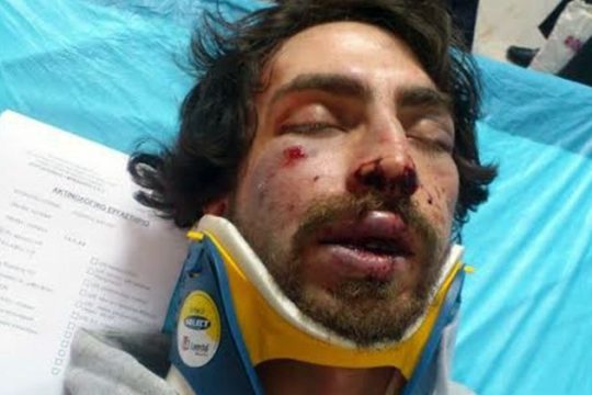 ΚΚΕ(μ-λ): αντιφασιστική συγκέντρωση το απόγευμα