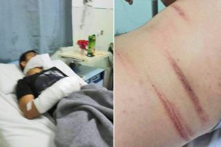 Λέρος: Επίθεση σε μετανάστες