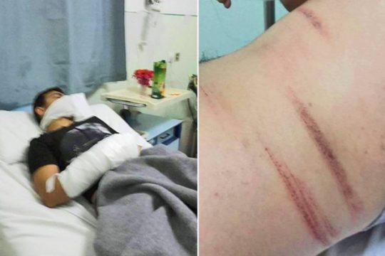 Λέρος: Επίθεση σε μετανάστες