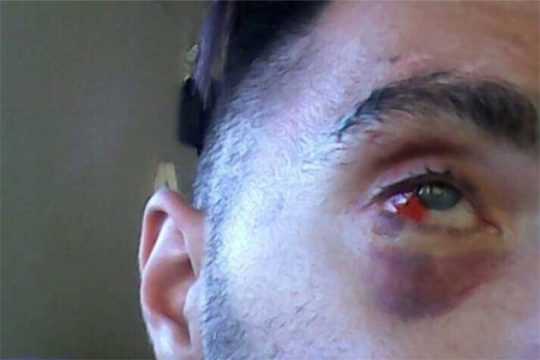 Καταγγελία για ομοφοβική επίθεση στο Ηράκλειο
