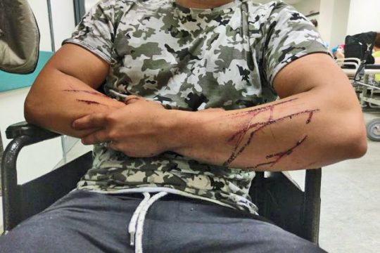 Μηχανοκίνητο «τάγμα» έστειλε στο νοσοκομείο 19χρονο πρόσφυγα
