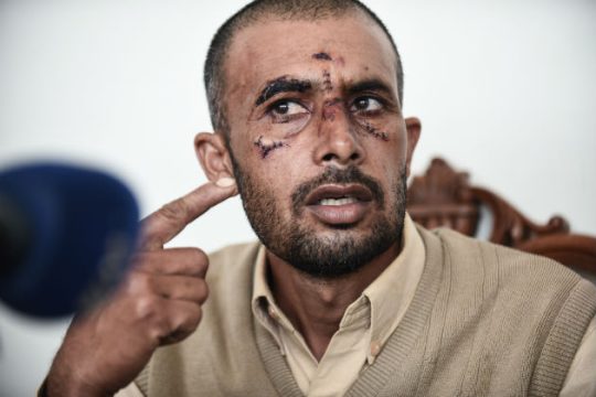 «Με χτυπήσανε πολύ»