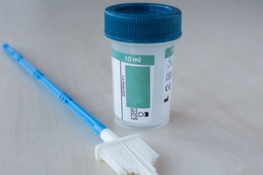 Δωρεάν τεστ ΠΑΠ στον Δήμο Κορυδαλλού