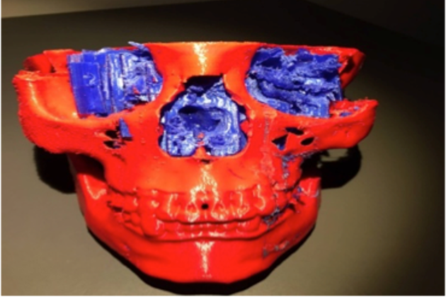 Για πρώτη φορά 3D ανθρώπινα όργανα στην Ελλάδα