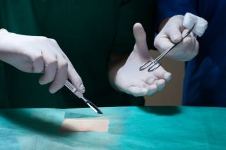 Αρση της άδειας για επεμβάσεις TAVI σε πολλές κλινικές