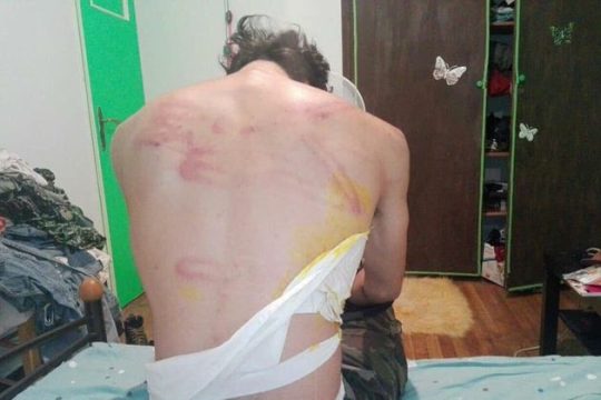 Αστυνομική βία σε βάρος προσφύγων