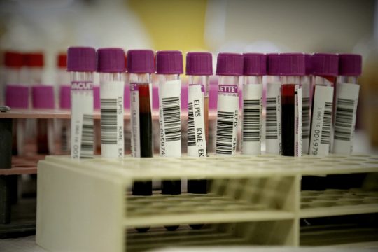 Εθελοντική αιμοδοσία με βάση την Αρχή της μη Διάκρισης