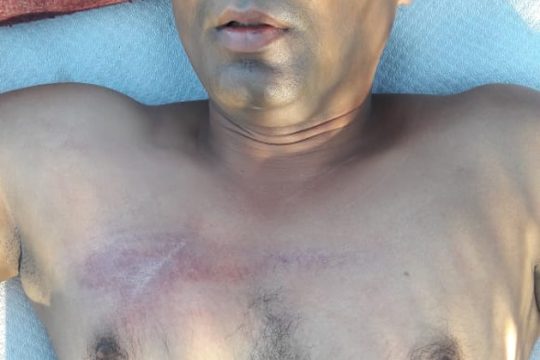 Ξύλο αντί για δεδουλευμένα