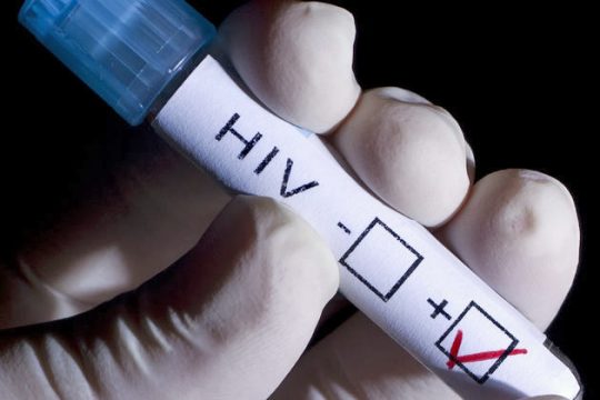 Αυξητικά ποσοστά του AIDS στις ηλικίες 50-64 ετών