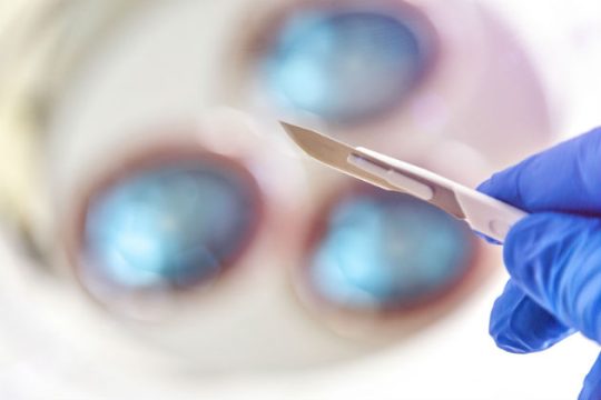 «Ανώφελη η αφαίρεση των αμυγδαλών για την πλειοψηφία των παιδιών»