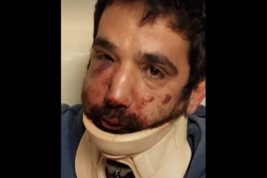 Αγριος ξυλοδαρμός διανομέα στη Θεσσαλονίκη