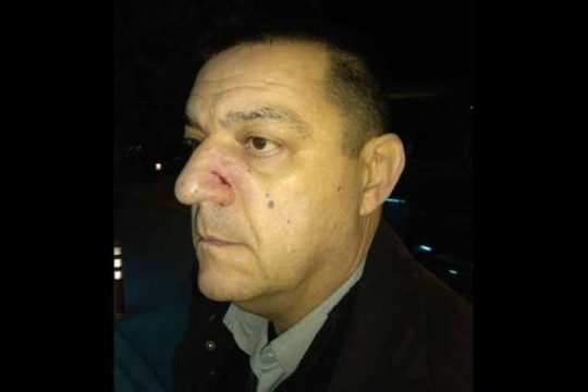 «Γαλάζιο» ξύλο στου Ζωγράφου
