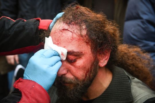 Στοχευμένες επιθέσεις των ταγμάτων εφόδου σε ανθρώπους του Τύπου