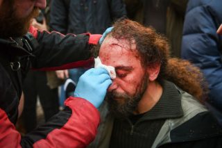 Π. Πολάκης: Η ιδιότυπη αριθμητική των τραυματιών του συλλαλητηρίου