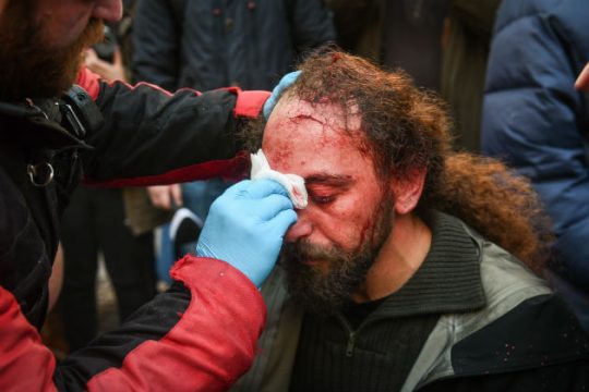 Π. Πολάκης: Η ιδιότυπη αριθμητική των τραυματιών του συλλαλητηρίου