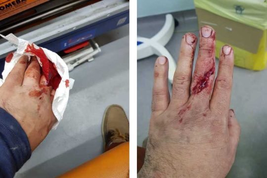 «Φασίστες μάς χτυπούσαν για να μας σκοτώσουν»