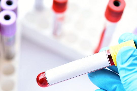 Ελπίδα ζωής από μια νέα θεραπεία