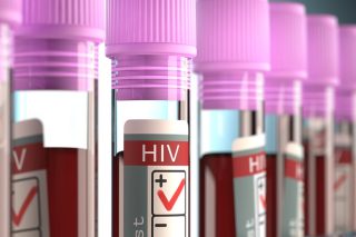 Τραγικές ελλείψεις στις μονάδες HIV