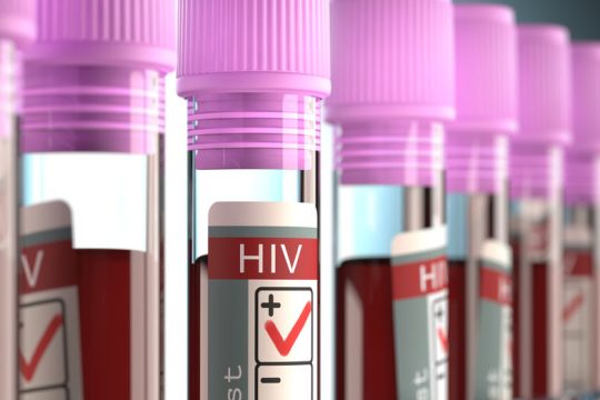 Τραγικές ελλείψεις στις μονάδες HIV
