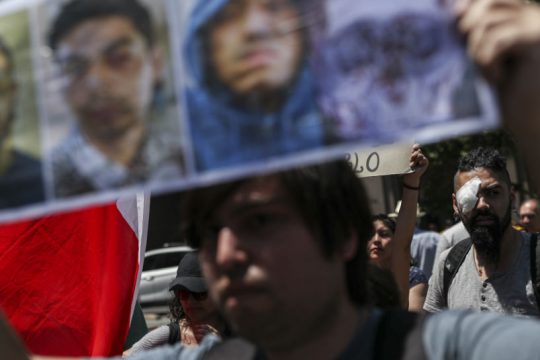 «Ζώντας στη Χιλή μέχρι να χάσεις το μάτι σου» 