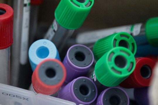 Τα μυστικά του τεστ για τον ιό και οι επιτήδειοι
