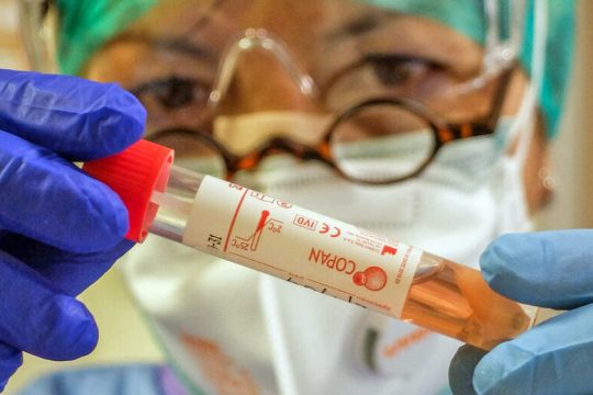 Κρύβουν τα κρούσματα στην Τουρκία για να σώσουν τον τουρισμό