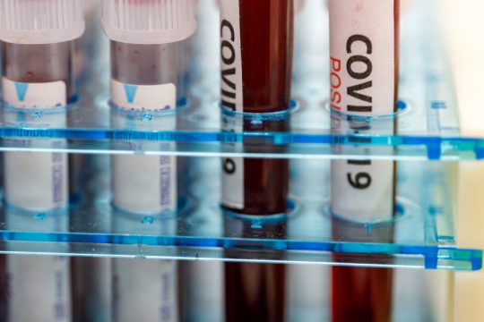 Ενστάσεις για ανεπαρκή συλλογή στοιχείων και έλλειψη διαφάνειας