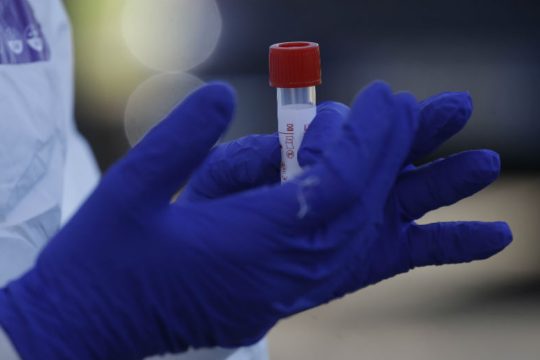 Νέα εκτίμηση από τον ΠΟΥ για Χανταϊό: «Θα μπορούσε να υπάρχει μετάδοση από άνθρωπο σε άνθρωπο»