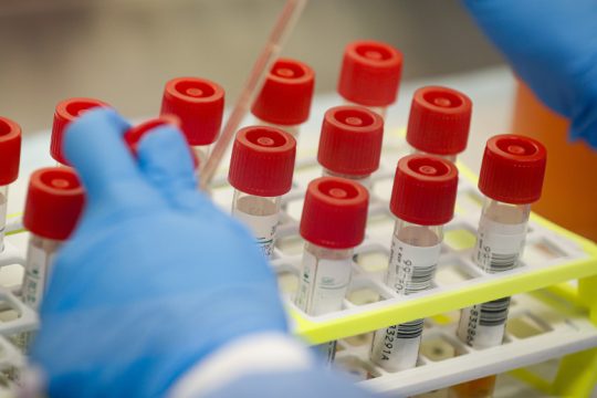 «Πρέπει να θεωρούμε ότι ο ιός αυτός είναι μια συνεχής απειλή»