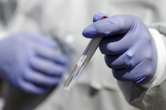 Ξεκινά στην Κρήτη η πρώτη οροεπιδημιολογική μελέτη για τον κορονοϊό