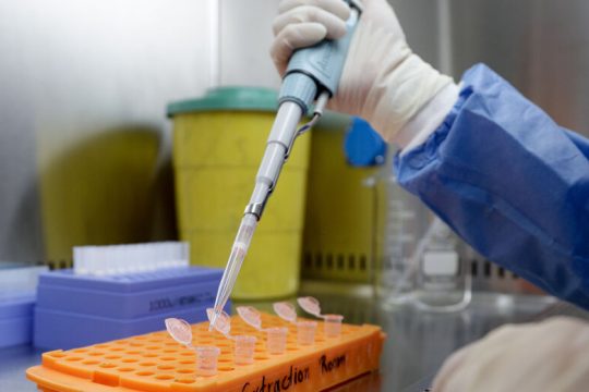 Σε ποιες περιπτώσεις είναι απαραίτητο το τεστ για κορονοϊό στα νοσοκομεία