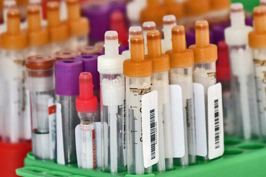 Λαμία: εισαγόμενα κρούσματα από τις ΗΠΑ