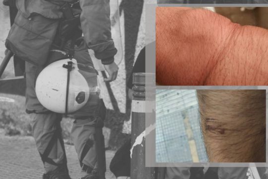 Από το Μαρόκο; «Βάλ’ του χειροπέδες»