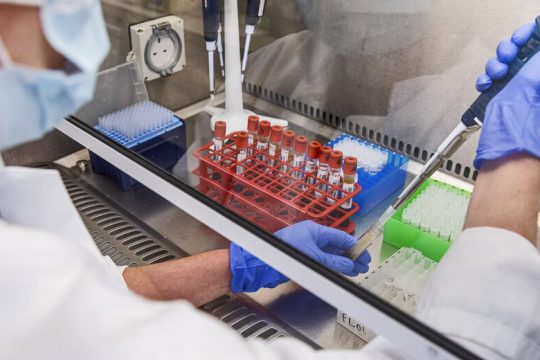 Ενθαρρυντικά νέα από την Οξφόρδη